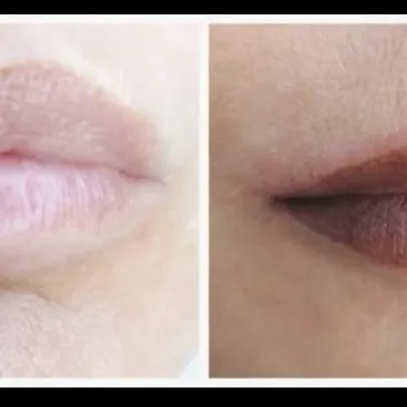 Trucco permanente prima e dopo